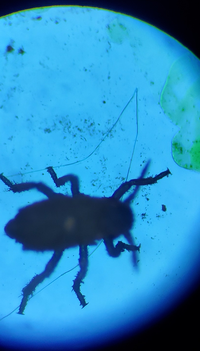 Aplid under Microscope
